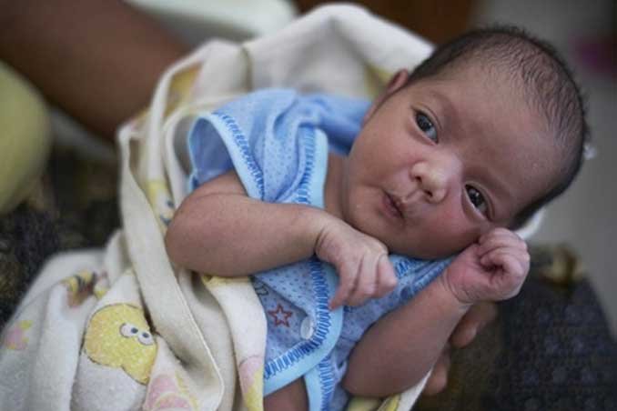 Congenital Disorders Treatment in Sonipat