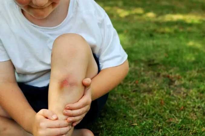 Children Injury Treatment in Sonipat