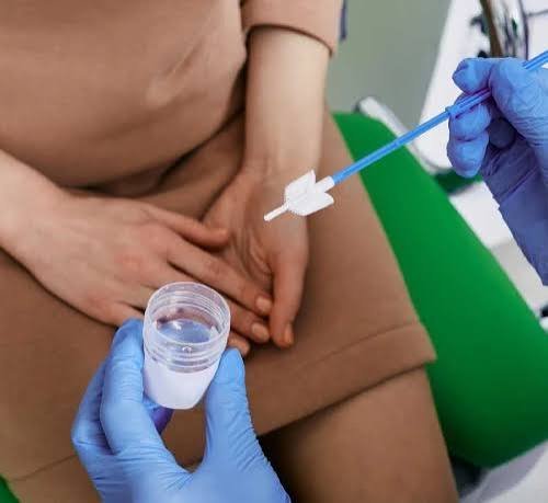 Pap Smear